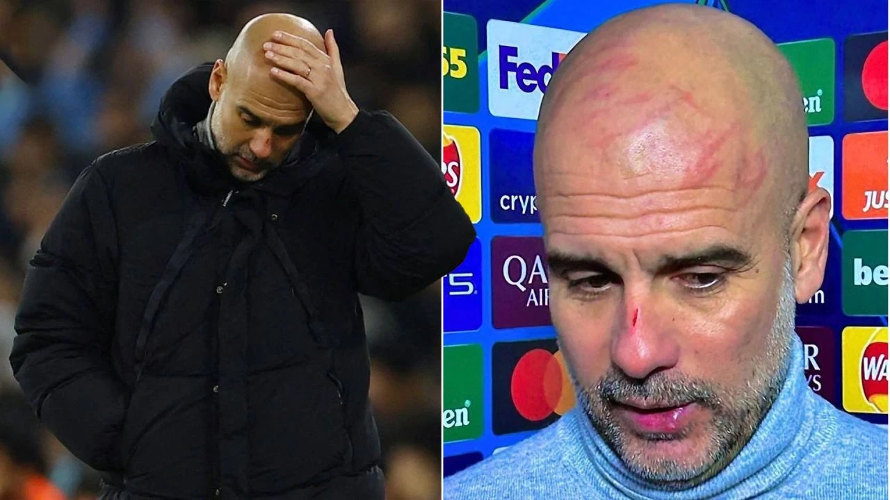 Pep Guardiola'nın yüzündeki yaralar gündem oldu! Şoke eden gerçeği bizzat kendisi açıkladı! - 2. Resim