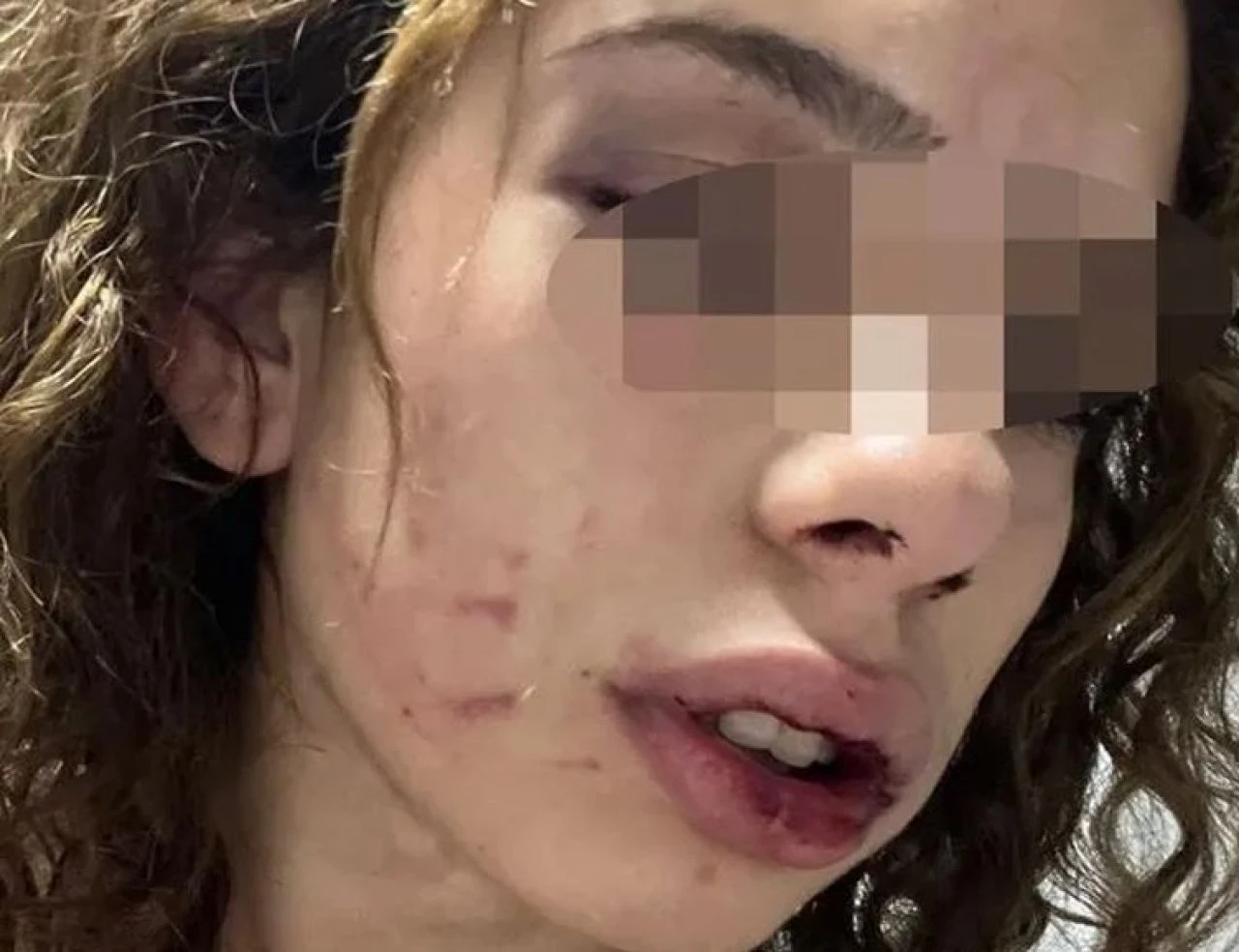 Sevgilisinden ayrılmak isteyen genç kıza öldüresiye dayak! İşkence sabaha kadar sürdü - 3. Resim