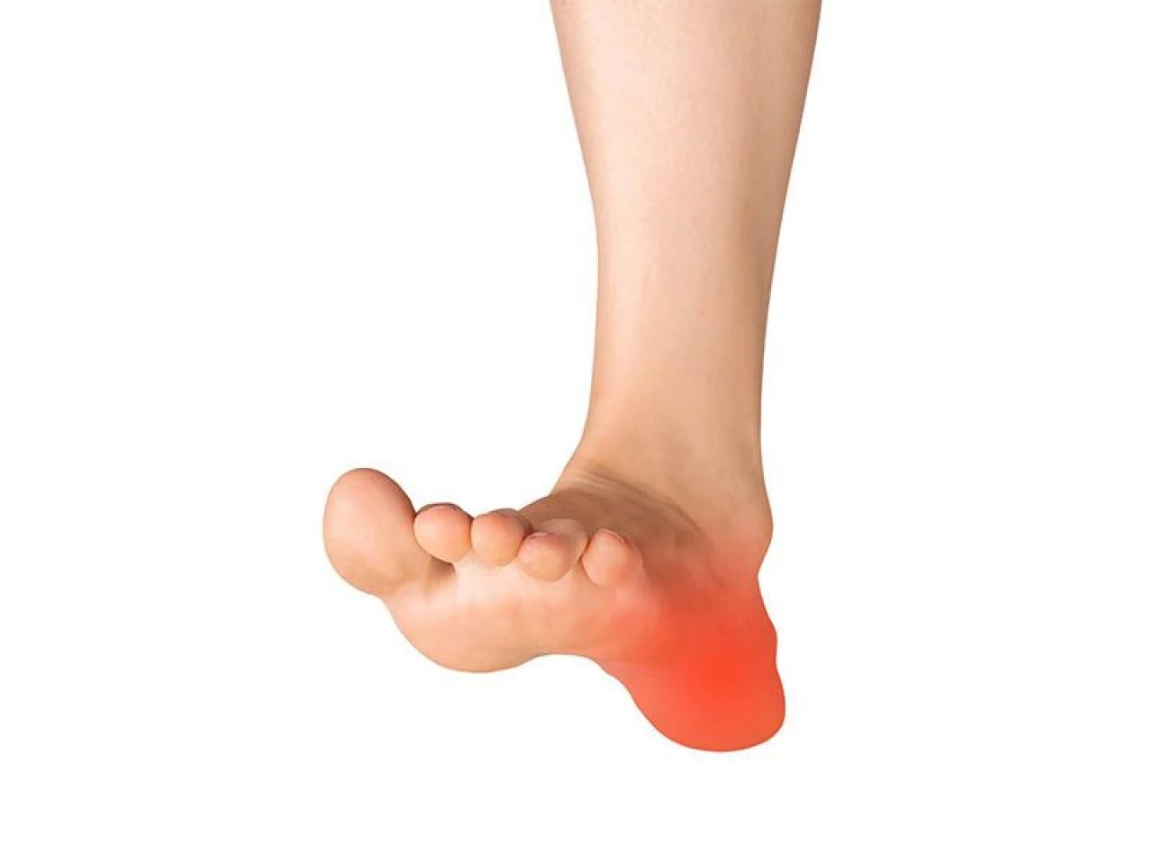 Topuk dikeni neden olur ve nasıl geçer? Topuk dikenine ne iyi gelir?