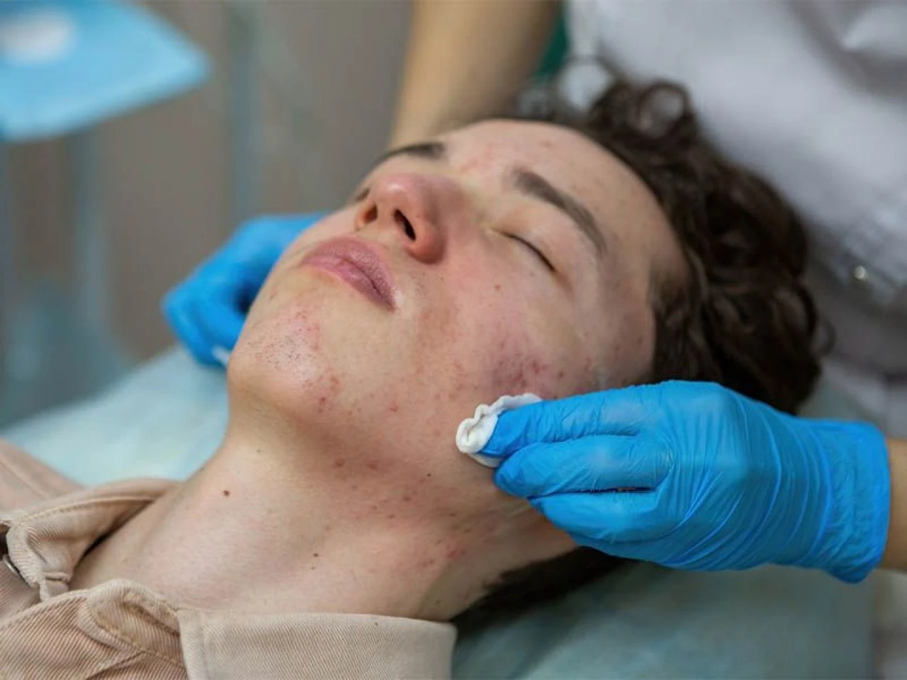 Yüzdeki lekeler neden olur, nasıl geçer? Yüzdeki lekeye ne iyi gelir?