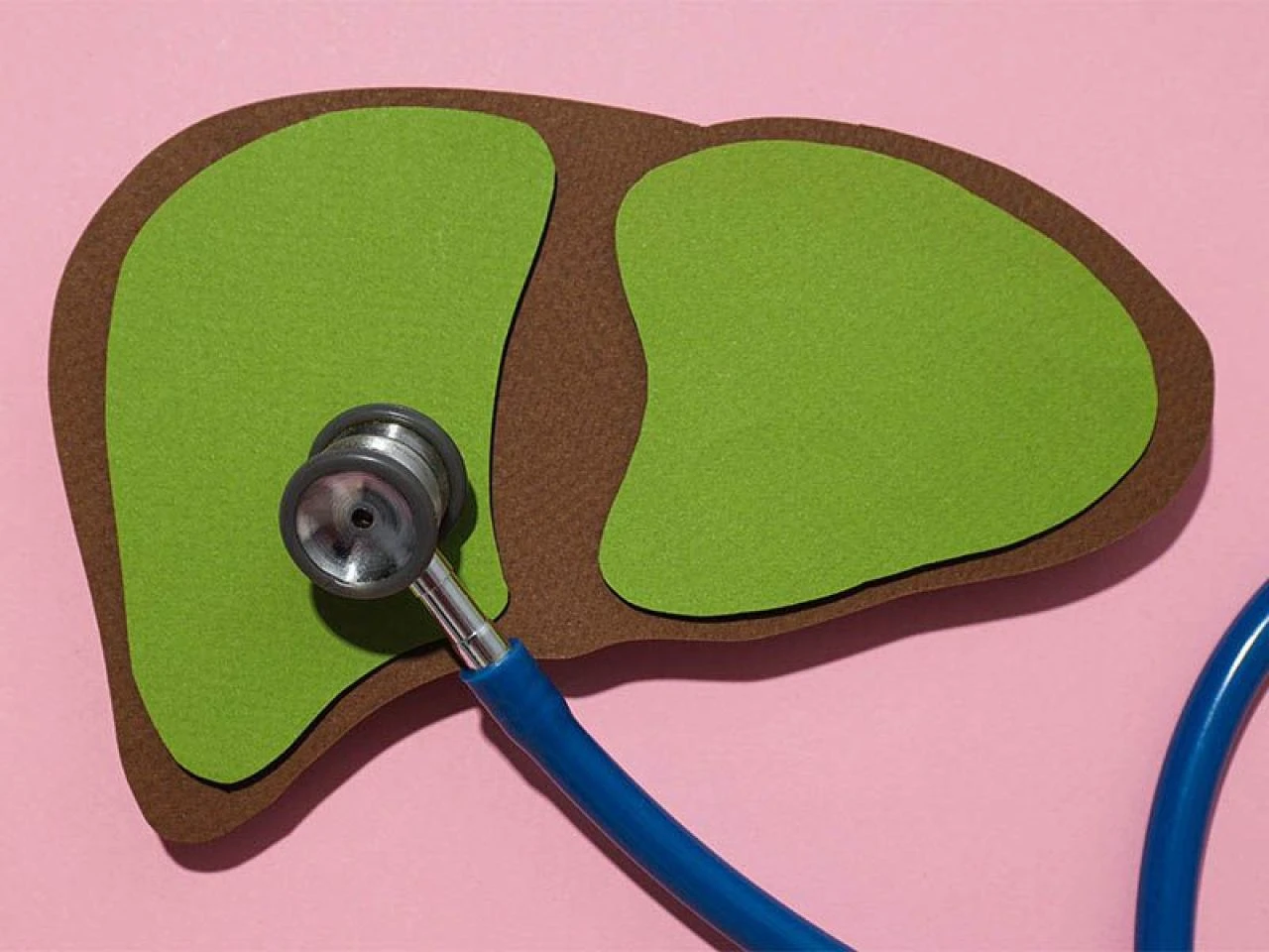 Karaciğer yağlanmasına iyi gelen doğal çözümler: Karaciğer yağlanmasına iyi gelen bitkiler, besinler ve kürler neler?