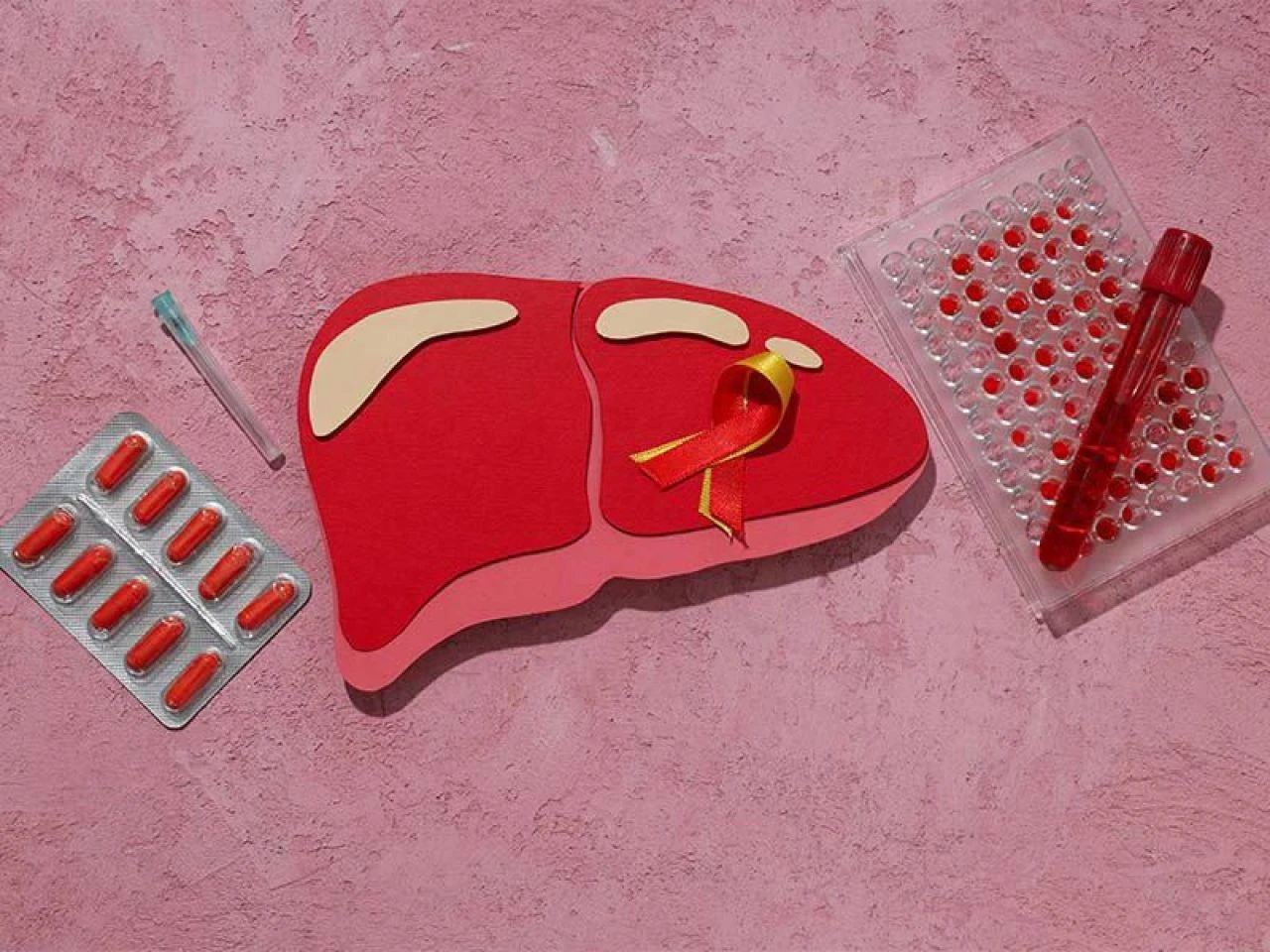 Karaciğer yağlanmasına iyi gelen doğal çözümler: Karaciğer yağlanmasına iyi gelen bitkiler, besinler ve kürler neler?