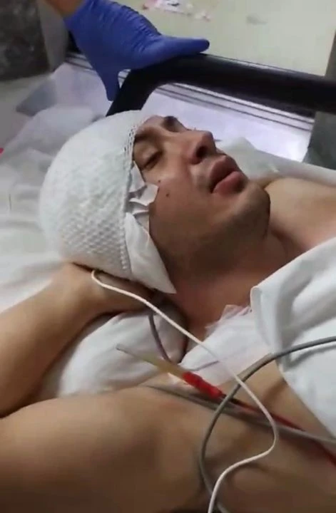 Başına mermi isabet eden uzman çavuşun inanılmaz kurtuluşu! İlk sözleri duygulandırdı Başına mermi isabet eden uzman çavuşun inanılmaz kurtuluşu! İlk sözleri duygulandırdı - 2. Resim