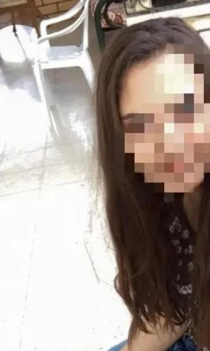 Yine bir estetik skandalı! Genç avukatın yaptırdığı dudak dolgusu hayatını kabusa çevirdi! - 1. Resim