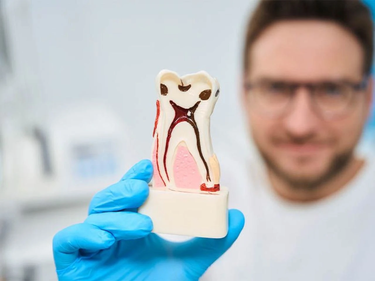 Diş çürüğü neden olur, en hızlı nasıl geçer? Diş çürüğü ağrısına ne iyi gelir? - 1. Resim