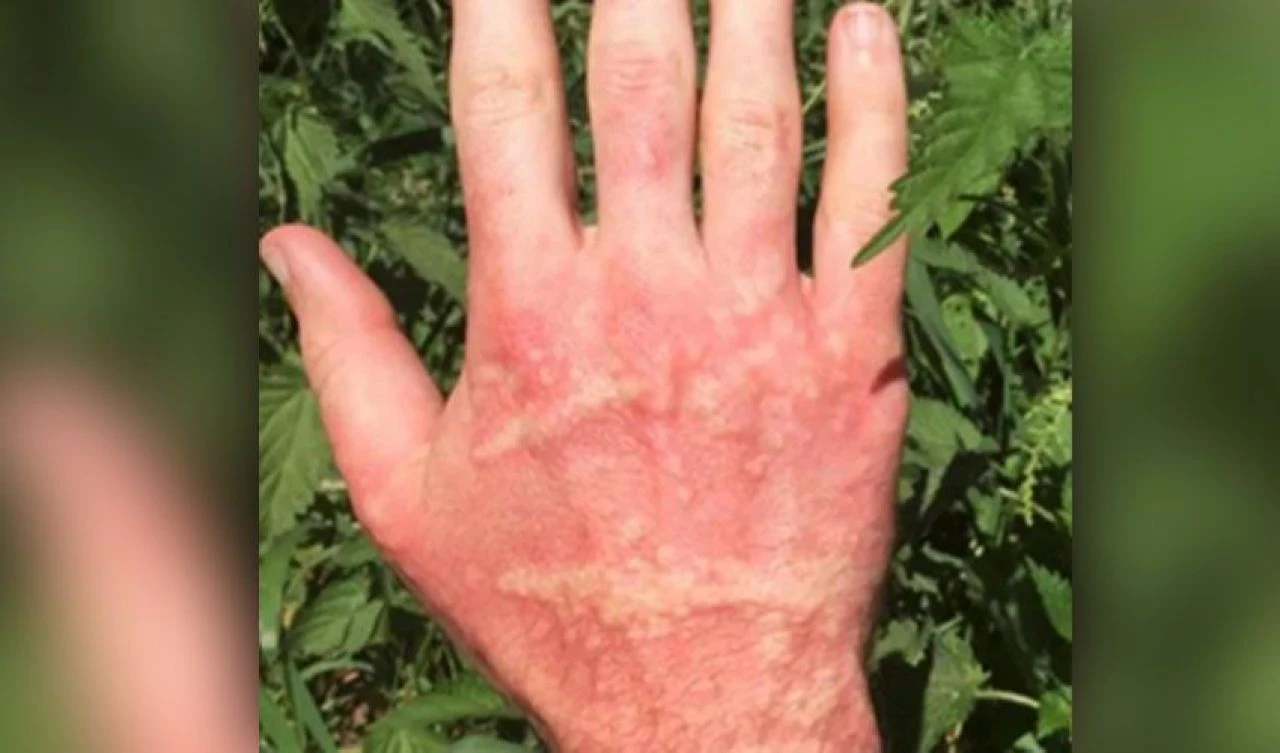 Dokunanı yakan istilacı bitki ülkenin sorunu haline geldi! Uzmanlardan uyarı geldi