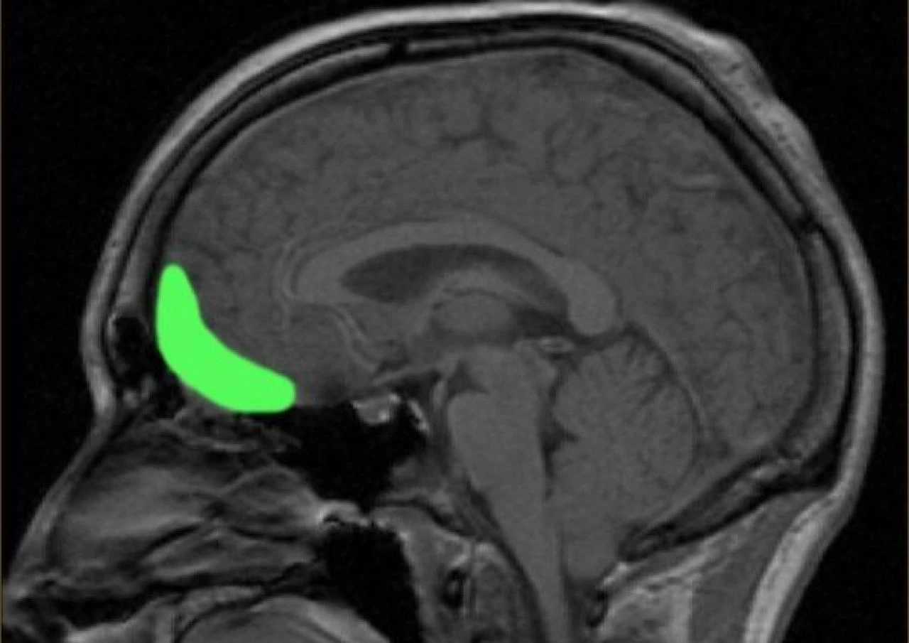 Çok şakacı ya da patavatsızsanız bir daha düşünün! Beyniniz hasarlı olabilir