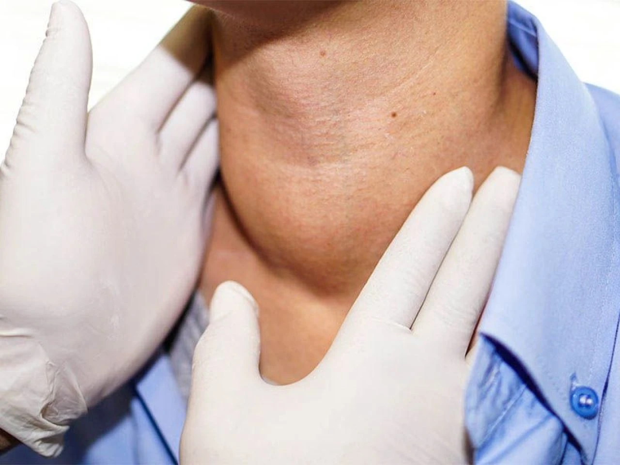 Boğaz enfeksiyonuna iyi gelen doğal yöntemler: Evde boğaz enfeksiyonuna iyi gelen şeyler, bitkiler ve çaylar neler? - 4. Resim