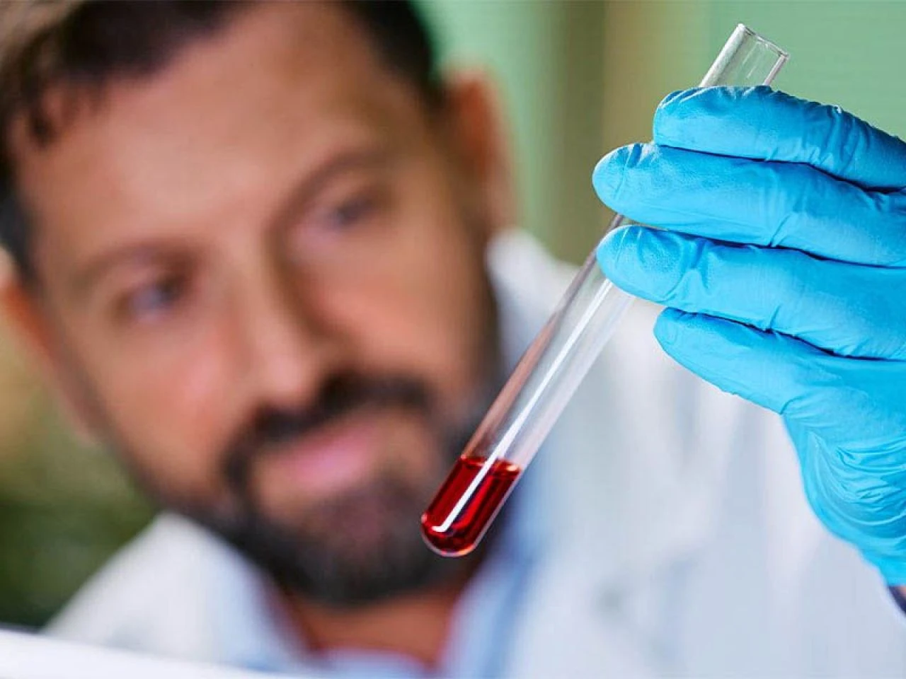 Kıl kurdu neden olur, en hızlı nasıl geçer? Kıl kurduna ne iyi gelir?