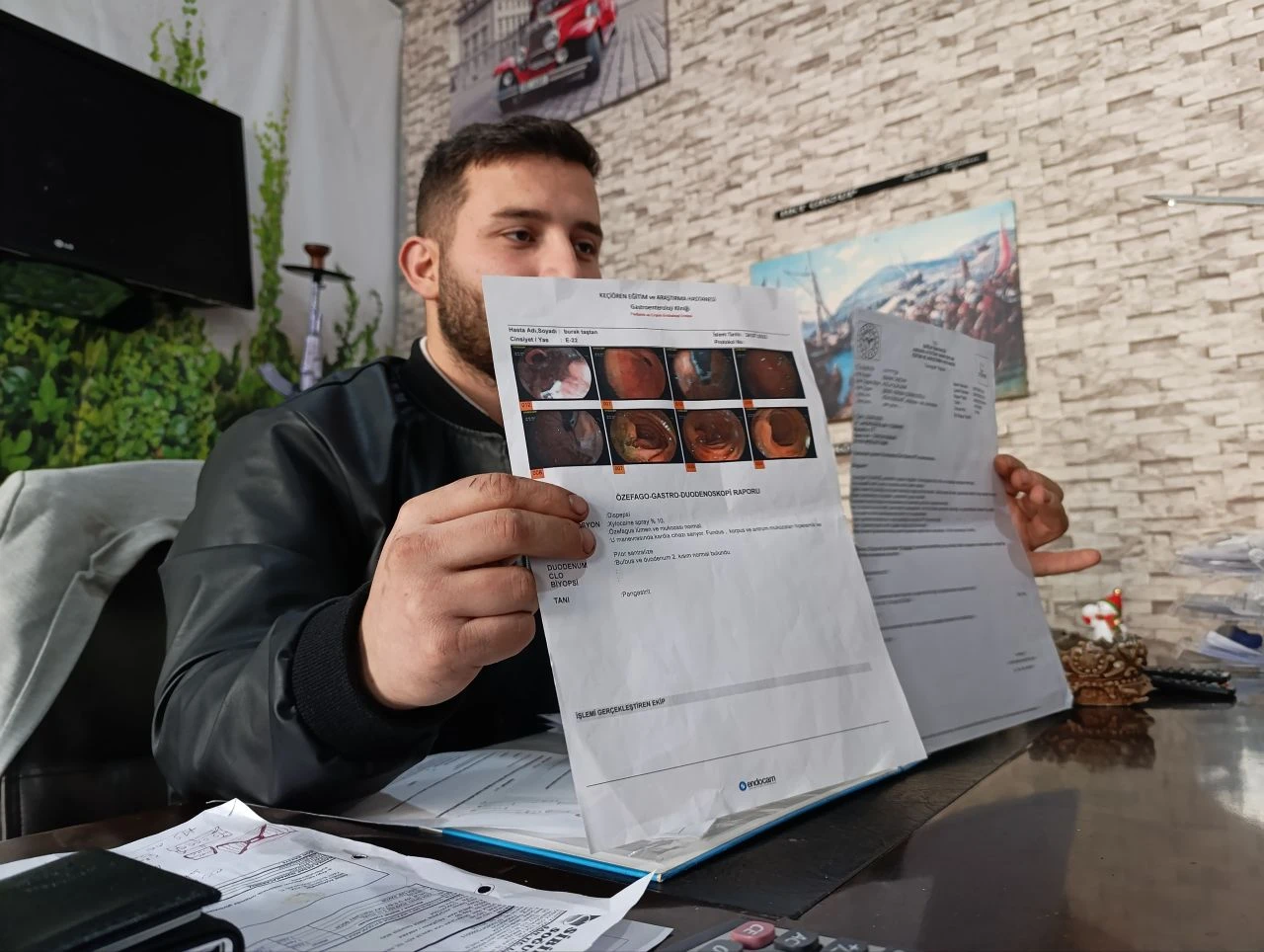 AVM'de tatlı yedi, hayatı kabusa döndü! Midesinde 3 adet cam parçası çıktı - 1. Resim