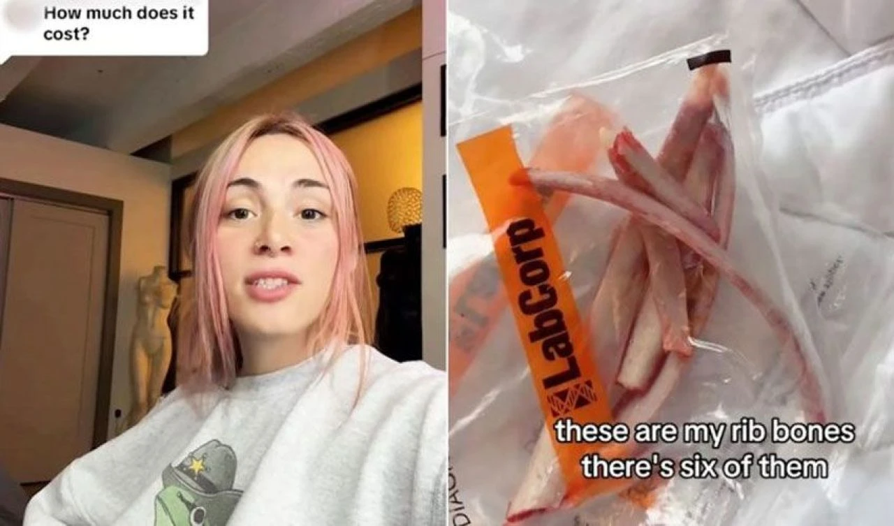 Belini inceltmek için şok edici bir yola başvurdu: Kemiklerimden kraliçe tacı yaptıracağım - 2. Resim