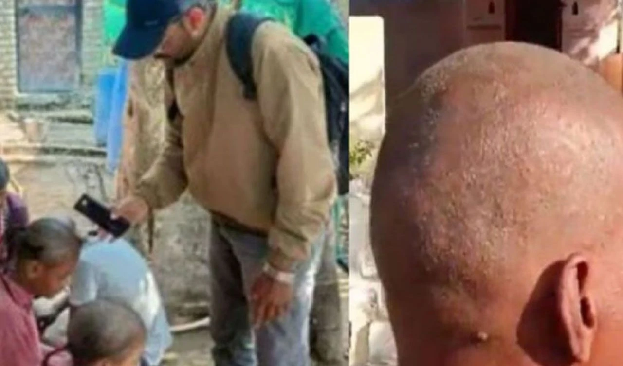 Hindistan'da gizemli virüs alarmı! 155 kişi aniden yakalandı - 1. Resim