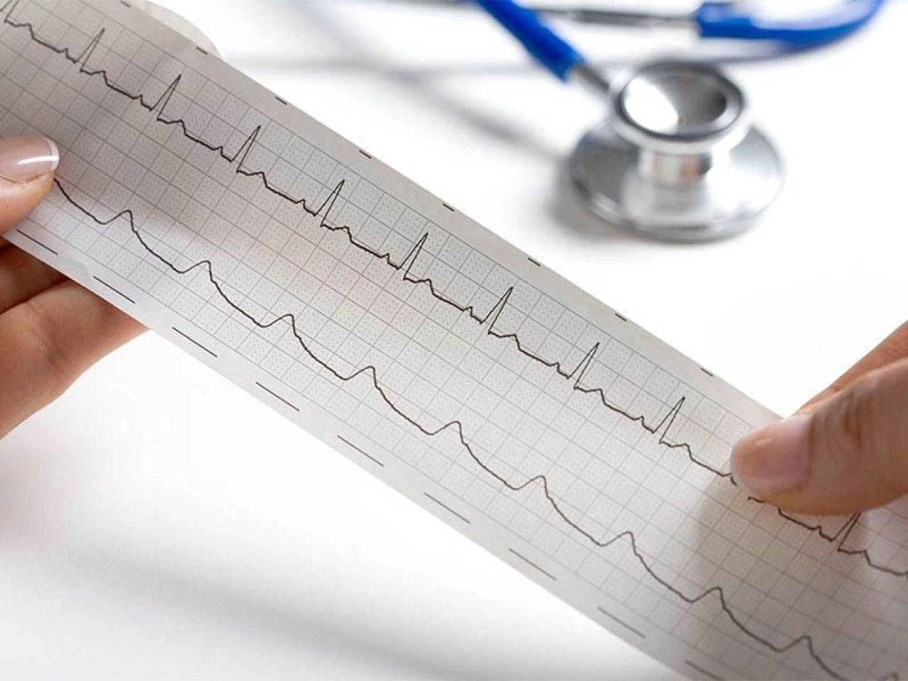 Kalp çarpıntısı neden olur ve ne iyi gelir? Kalp çarpıntısı nasıl geçer? - 2. Resim