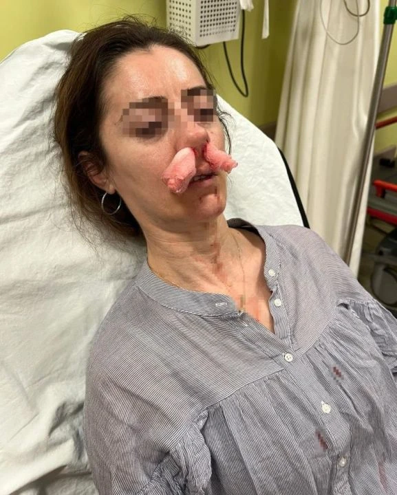 Kocasının sevgilisine benzettiği kadını darbetti! Savunması 'pes' dedirtti - 2. Resim