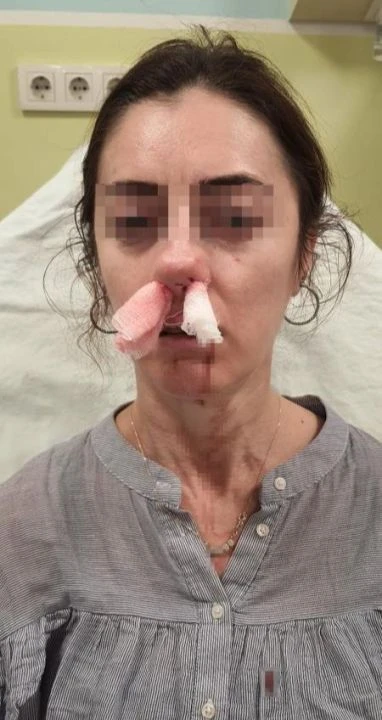 Kocasının sevgilisine benzettiği kadını darbetti! Savunması 'pes' dedirtti - 3. Resim