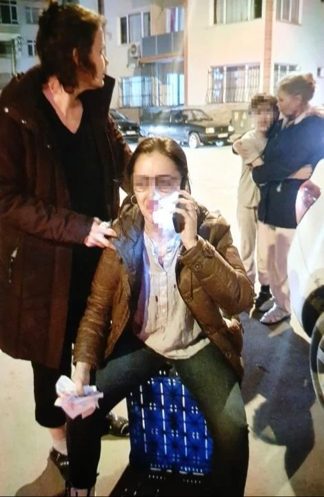 Kocasının sevgilisine benzettiği kadını darbetti! Savunması 'pes' dedirtti - 1. Resim