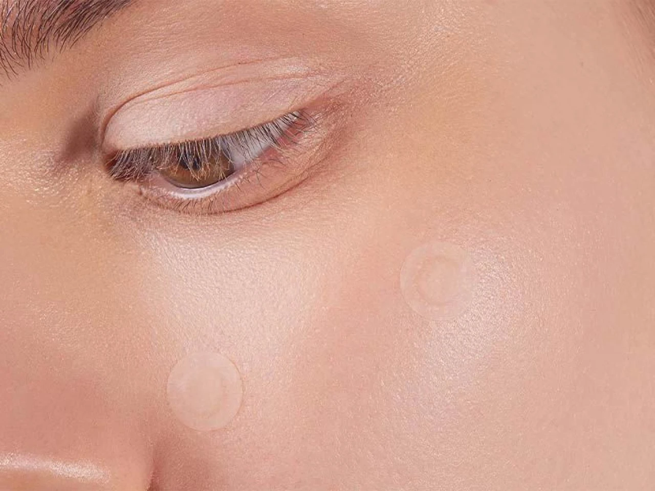 Göz altı yağ bezeleri neden olur ve nasıl geçer? Göz altındaki yağ bezesine ne iyi gelir?