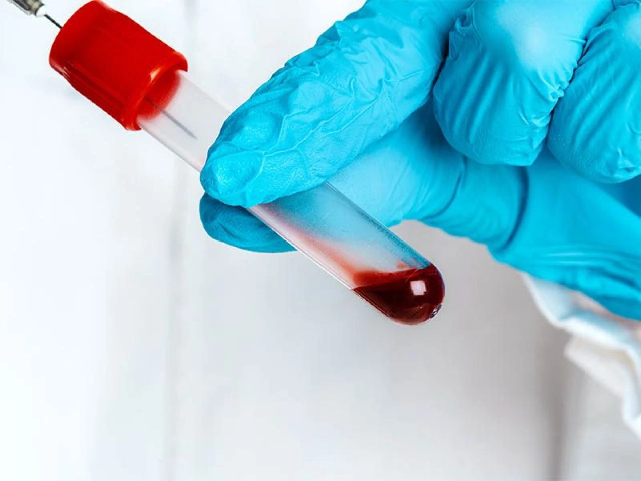 Kanda enfeksiyon neden olur ve nasıl geçer? Kandaki enfeksiyon nasıl atılır? - 1. Resim