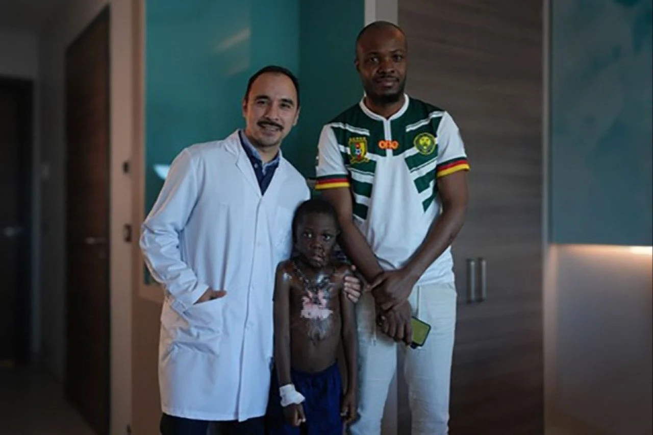 Boynu yanan çocuğun çenesi gövdesine yapıştı! Kafasını bile kaldıramıyordu - 1. Resim