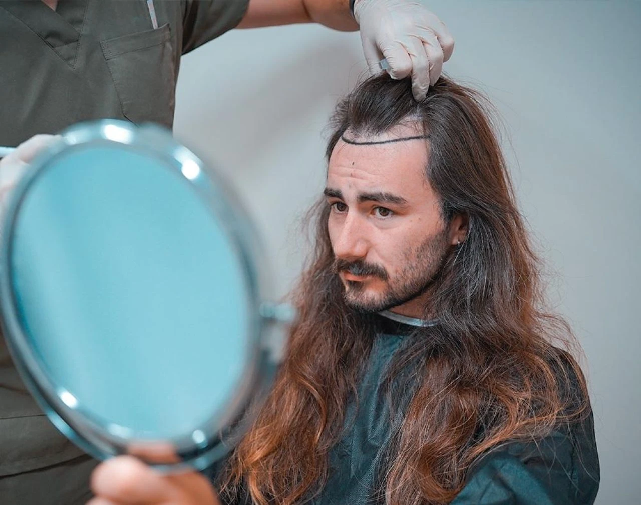 Saç ektirmek, yeni yöntem sonrası tarih oluyor! Doğal saç çıkarmayı etkileyen 'anahtar' keşfedildi