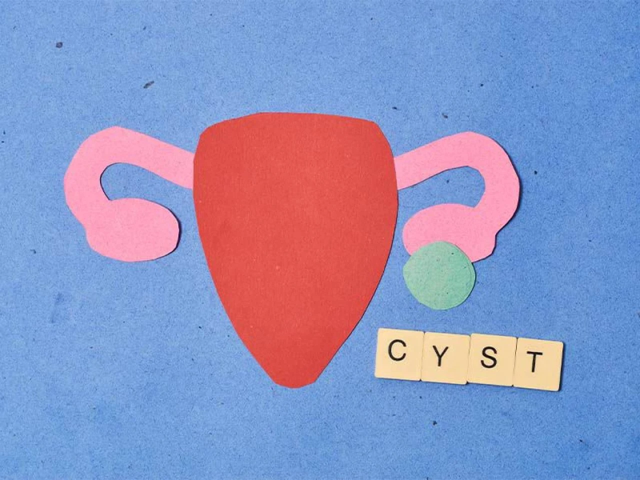 Sistit nedir, neden olur ve nasıl geçer? Sistite ne iyi gelir? - 1. Resim