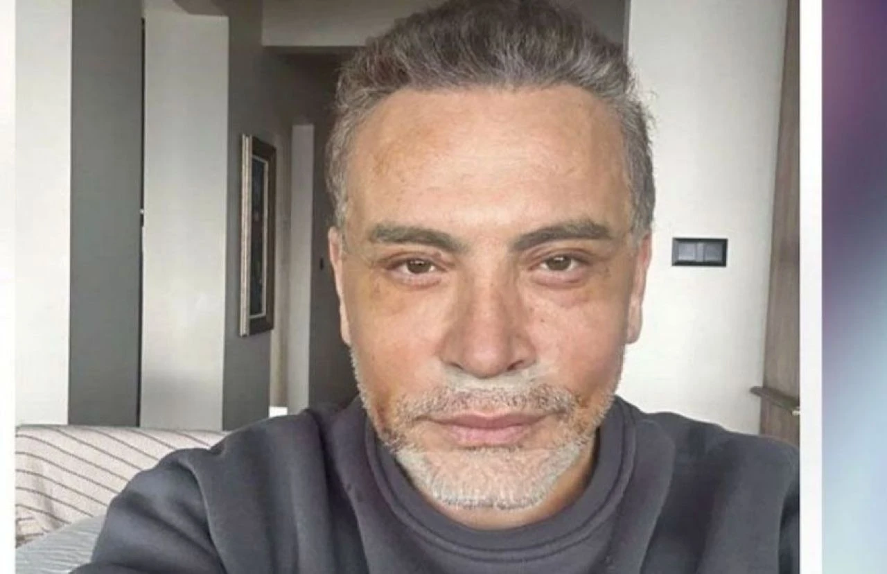 Cenk Eren neden estetik olduğunu açıkladı! Son halini paylaştı - 2. Resim