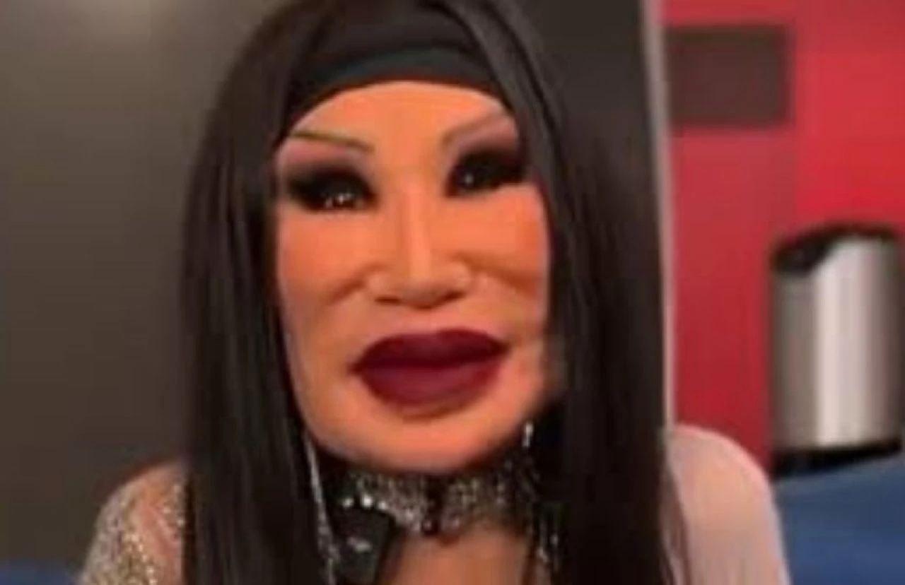 Ünlü oyuncunun estetik tutkusu pahalıya mal oldu! Bir zamanlar güzelliği dillere destandı - 2. Resim