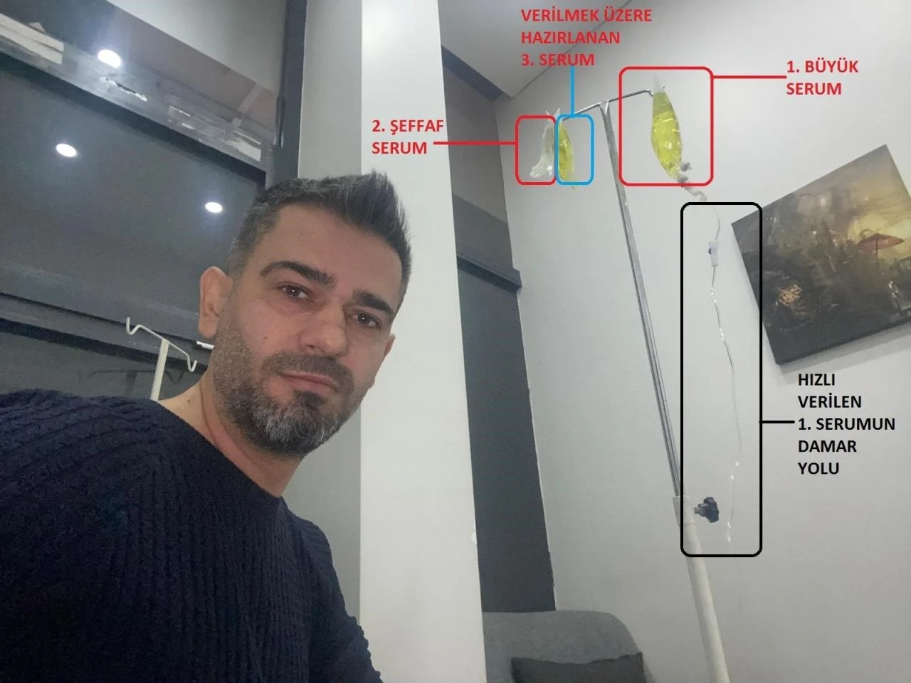 Sarı serum faciasında korkunç detaylar! Hastanın kanını değiştirince... - 2. Resim