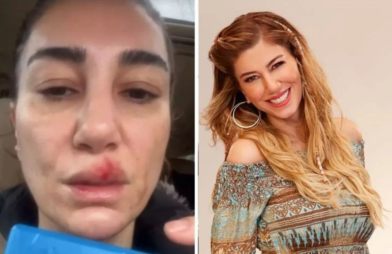 Evinde kaza geçiren Nadide Sultan hastanelik oldu