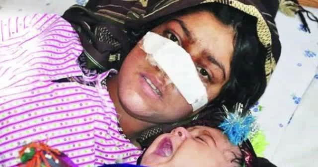 Eşi burnunu kesti, Türk doktorlar tedavi etti