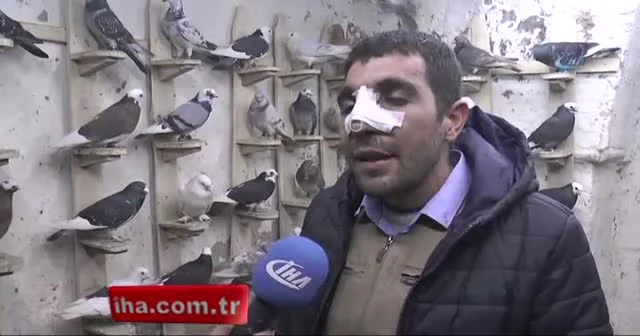 Ameliyattan çıkar çıkmaz güvercinlere koştu