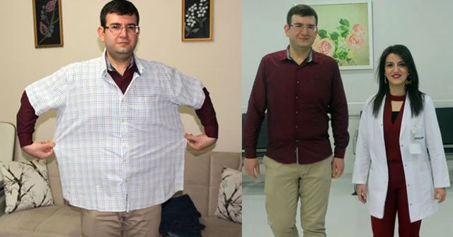 Diyetle 8 ayda 45 kilo verdi