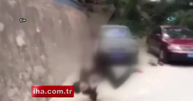 Takla atmak isterken kolunu kırdı