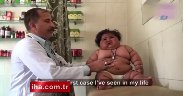 Hindistan’da 8 aylık bebek 17 kilo ağırlında