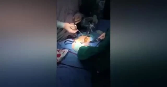 Adamın karnından canlı yılan çıktı