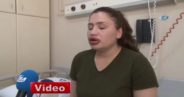 Silikon faciası kurbanı hemşirenin estetik uzmanı kuaför çıktı