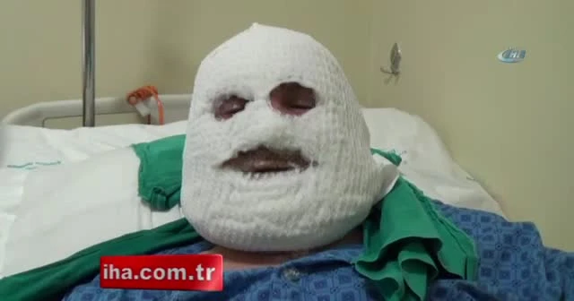 Biriken gaz bomba gibi patladı
