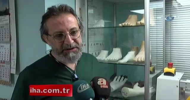 Özge yeni protezine kavuşmak için gün sayıyor