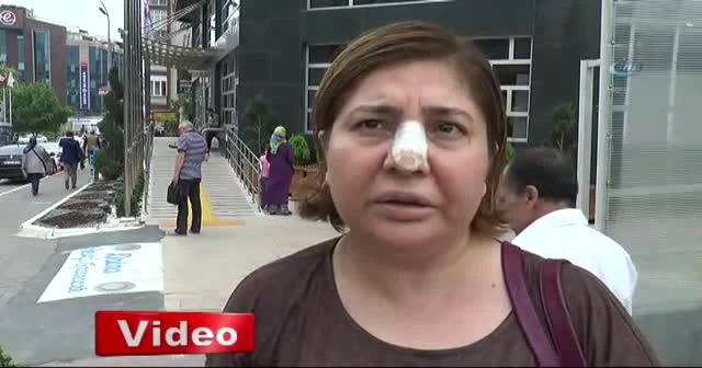 Yanlış yıkama ve kimyasal yüzünden saçından oldu iddiası