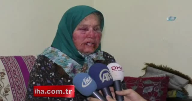 'Oğlunun arkadaşıyım' diye kapıyı çalıp yaşlı kadını öldüresiye dövdü