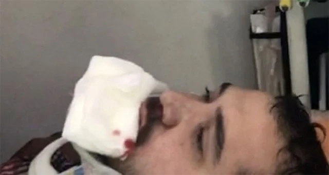 AK Parti seçim aracının şoförü darp edildi