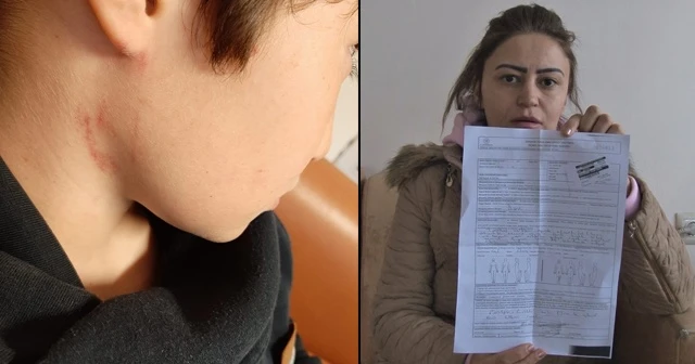 10 yaşındaki öğrencisini yerden yere vurdu