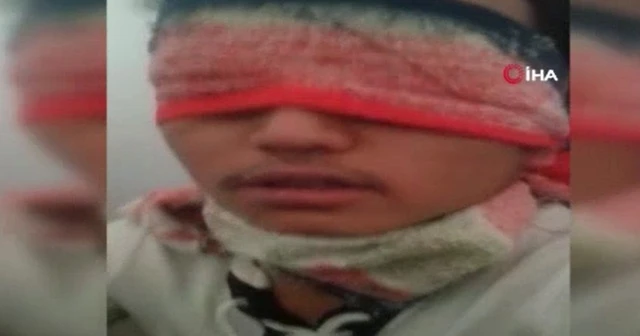 Fidye için kaçırılan Afgan, elleri ve gözleri bağlı halde bulunarak kurtarıldı