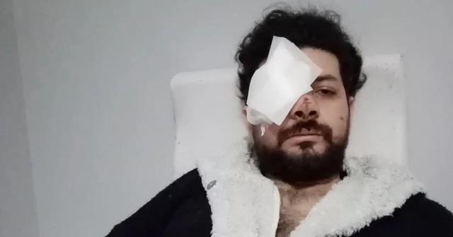 Gözünü kaybeden genç şarkıcı konuştu