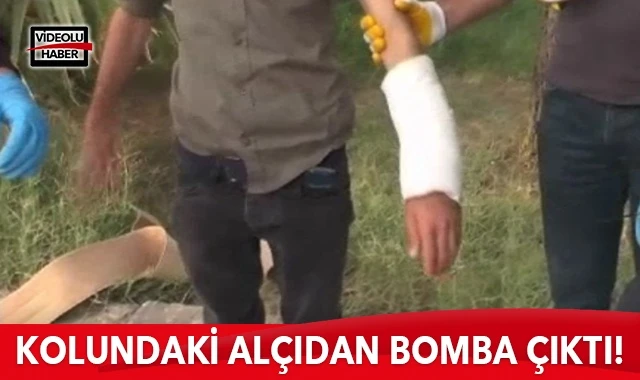 Kolundaki alçıdan bomba çıktı