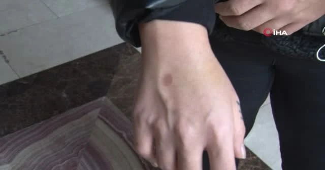 Şişli’de dakikalarca darp edilen kadın yaşadığı dehşet anlarını anlattı