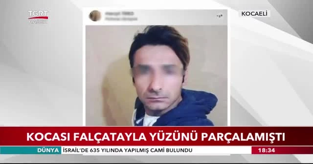 Kocası falçatayla yüzünü parçalamıştı