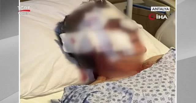 Kafesten kaçan maymun bir kişiye saldırdı