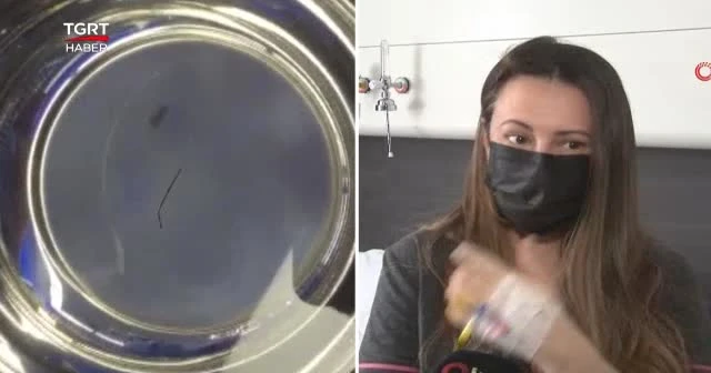 Kokoreç yerken diline iğne battı