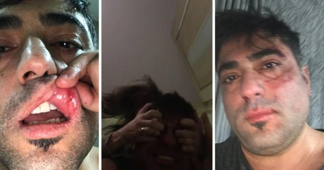 Yabancı uyruklu kadın kocasını feci şekilde darp etti